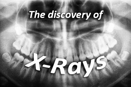 Bolivia dentists at Coastal Pediatric Dentistry discusses the discovery of x-rays and how they have advanced over the years.