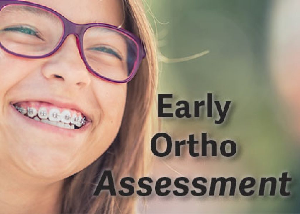 Bolivia dentist, Dr. Cecilia Liu and Dr. Nichole Ramsbottom at Coastal Pediatric Dentistry gives 5 reasons why early orthodontic assessment can prove beneficial for your child’s oral health.